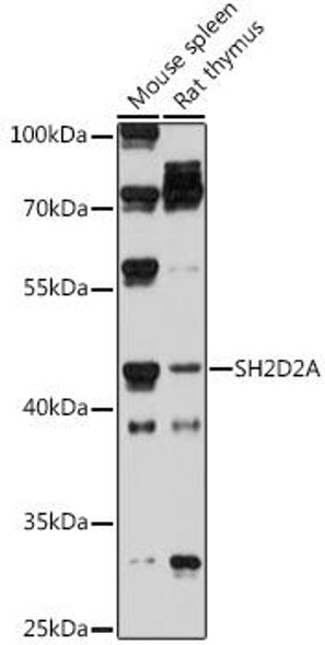 Cell Biology Antibodies 18 Anti-SH2D2A Antibody CAB18401