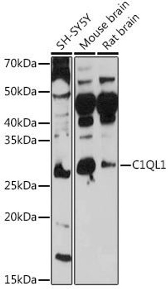 Cell Biology Antibodies 18 Anti-C1QL1 Antibody CAB18419