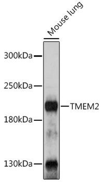Cell Biology Antibodies 17 Anti-TMEM2 Antibody CAB18439