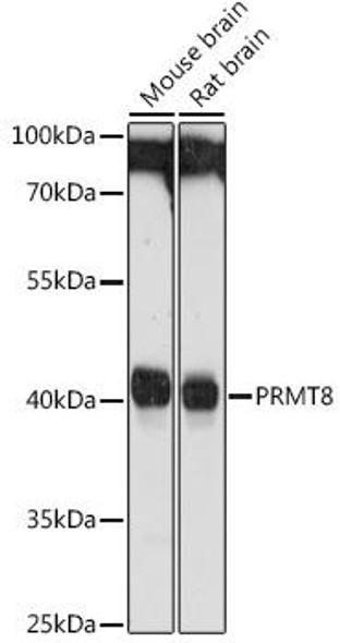KO Validated Antibodies 2 Anti-PRMT8 Antibody CAB18440KO Validated