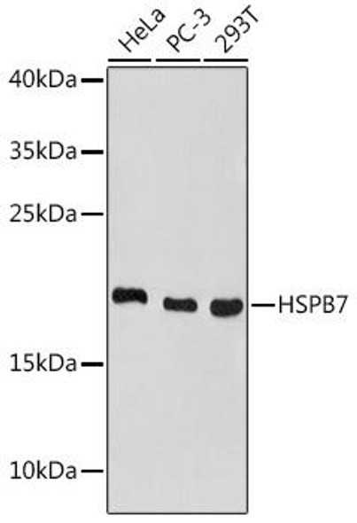 Cell Biology Antibodies 17 Anti-HSPB7 Antibody CAB18450