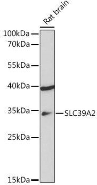 Cell Biology Antibodies 17 Anti-SLC39A2 Antibody CAB18452