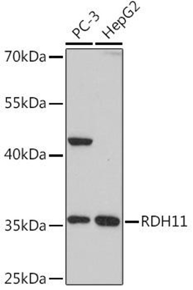 Cell Biology Antibodies 17 Anti-RDH11 Antibody CAB18454