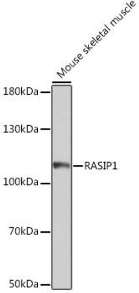 Cell Biology Antibodies 17 Anti-RASIP1 Antibody CAB18466