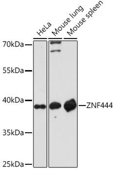 Cell Biology Antibodies 17 Anti-ZNF444 Antibody CAB18470