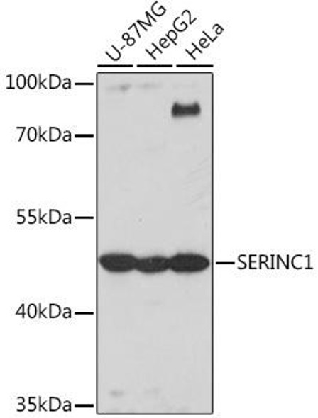Cell Biology Antibodies 17 Anti-SERINC1 Antibody CAB18478
