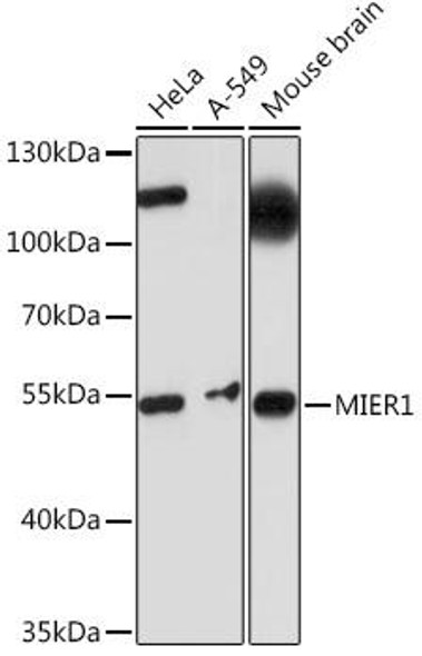 Cell Biology Antibodies 17 Anti-MIER1 Antibody CAB18480