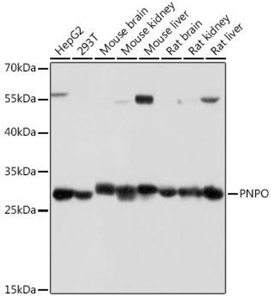 Cell Biology Antibodies 17 Anti-PNPO Antibody CAB18495