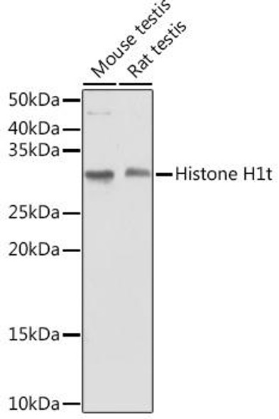 Cell Biology Antibodies 17 Anti-Histone H1t Antibody CAB18496