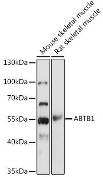 Cell Biology Antibodies 17 Anti-ABTB1 Antibody CAB18499