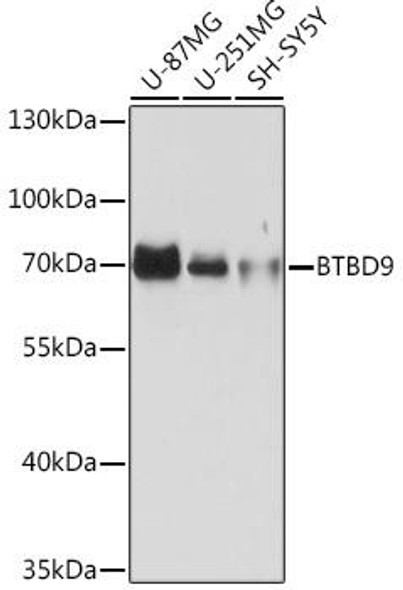 Cell Biology Antibodies 15 Anti-BTBD9 Antibody CAB18528