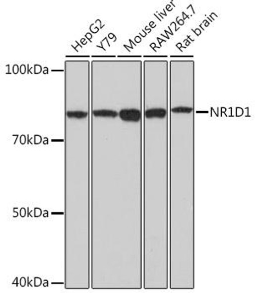 Cell Biology Antibodies 17 Anti-NR1D1 Antibody CAB18602