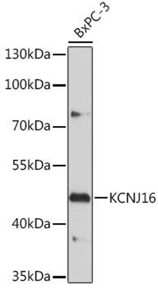 Cell Biology Antibodies 15 Anti-KCNJ16 Antibody CAB18635