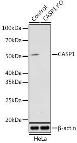 KO Validated Antibodies 2 Anti-CASP1 Antibody CAB18646KO Validated