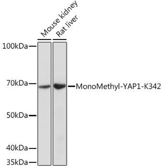 Epigenetics and Nuclear Signaling Antibodies 5 Anti-MonoMethyl-YAP1-K342 Antibody CAB18651