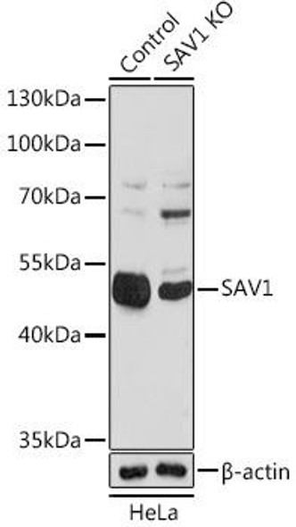 KO Validated Antibodies 2 Anti-SAV1 Antibody CAB18667KO Validated