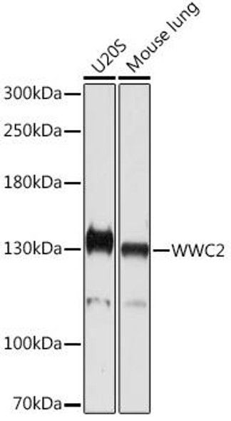 Cell Biology Antibodies 15 Anti-WWC2 Antibody CAB18668