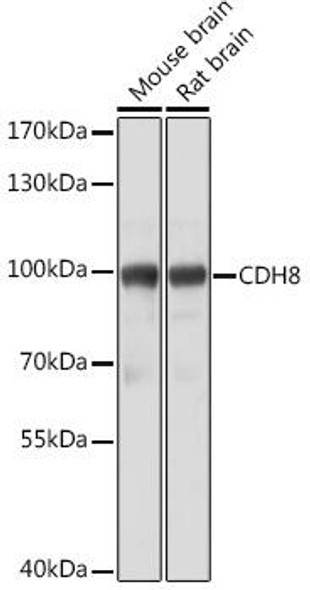 Cell Biology Antibodies 15 Anti-CDH8 Antibody CAB18691