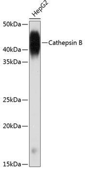 Cell Biology Antibodies 17 Anti-Cathepsin B Antibody CAB19005