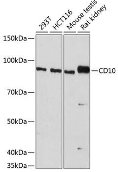 Cell Biology Antibodies 17 Anti-CD10 Antibody CAB19007