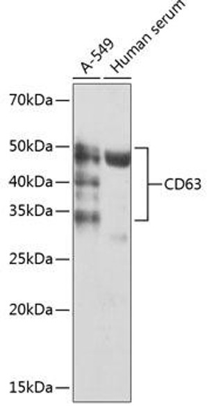 Cell Biology Antibodies 17 Anti-CD63 Antibody CAB19023