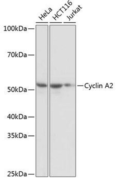 Cell Cycle Antibodies 2 Anti-Cyclin A2 Antibody CAB19036