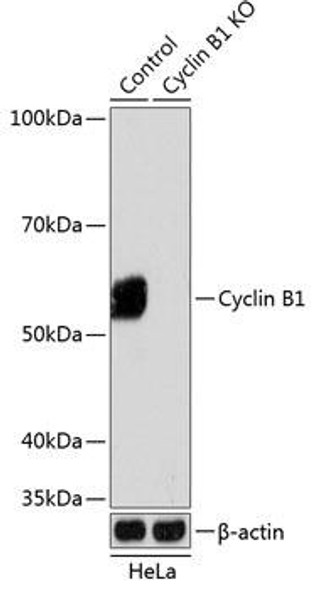 KO Validated Antibodies 2 Anti-Cyclin B1 Antibody KO Validated CAB19037