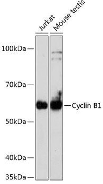 KO Validated Antibodies 2 Anti-Cyclin B1 Antibody KO Validated CAB19037