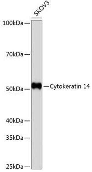 Cell Biology Antibodies 17 Anti-Cytokeratin 14 Antibody CAB19039