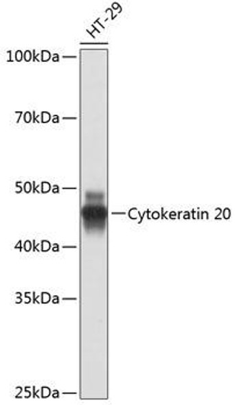 Cell Death Antibodies 2 Anti-Cytokeratin 20 Antibody CAB19041