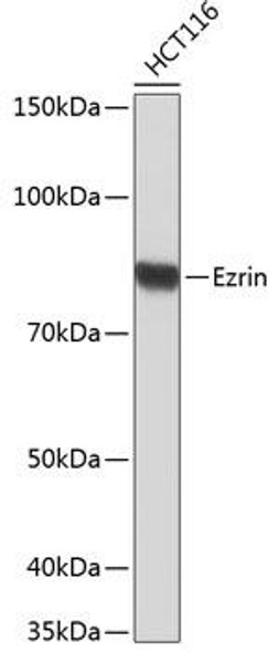 Cell Biology Antibodies 17 Anti-Ezrin Antibody CAB19048