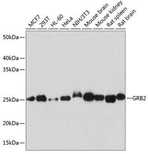 Immunology Antibodies 3 Anti-GRB2 Antibody CAB19059
