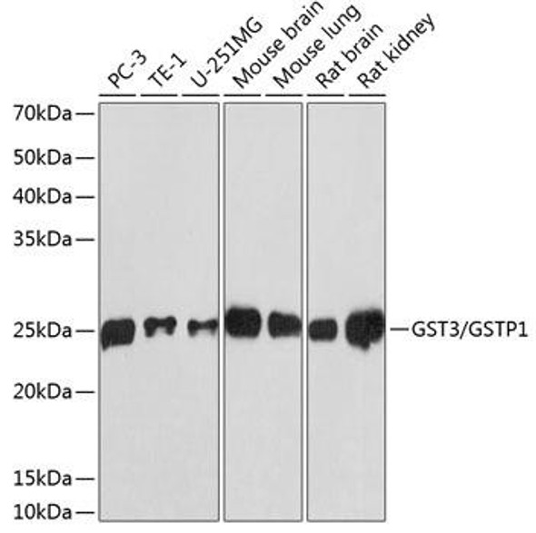 Cell Biology Antibodies 17 Anti-GST3 / GSTP1 Antibody CAB19061