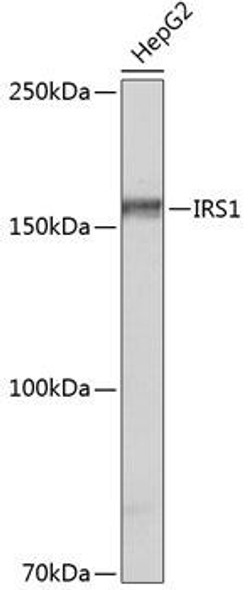 Cell Biology Antibodies 17 Anti-IRS1 Antibody CAB19074