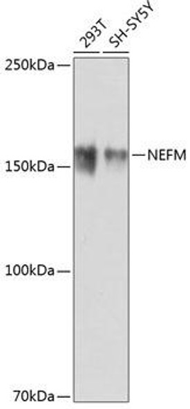 Cell Biology Antibodies 17 Anti-NEFM Antibody CAB19085