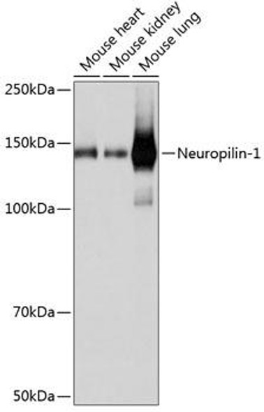 Cardiovascular Antibodies Anti-Neuropilin-1 Antibody CAB19087