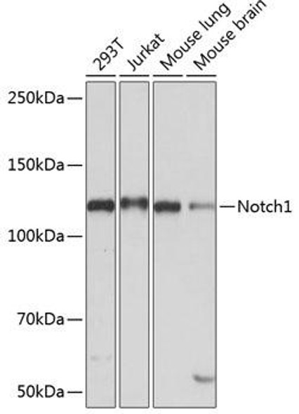 Cardiovascular Antibodies Anti-Notch1 Antibody CAB19090