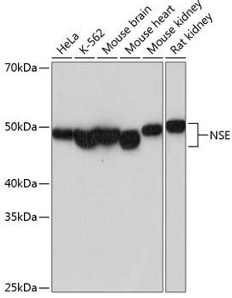 Metabolism Antibodies 3 Anti-NSE Antibody CAB19091