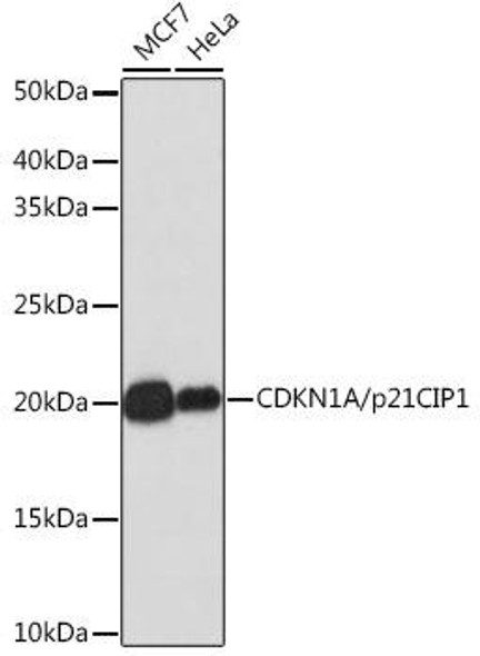 KO Validated Antibodies 2 Anti-CDKN1A/p21CIP1 Antibody KO Validated CAB19094