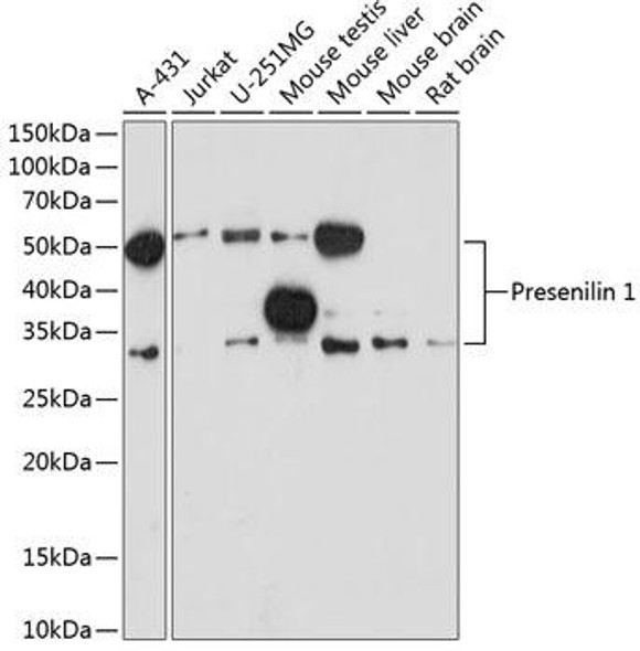 Cell Death Antibodies 2 Anti-Presenilin 1 Antibody CAB19103