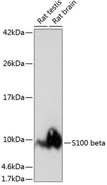 Cell Biology Antibodies 17 Anti-S100 beta Antibody CAB19108