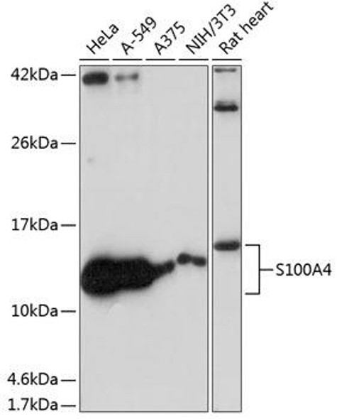 Cell Biology Antibodies 17 Anti-S100A4 Antibody CAB19109