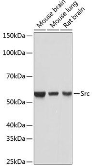 KO Validated Antibodies 2 Anti-Src Antibody KO Validated CAB19119