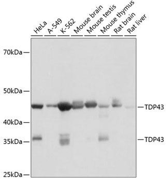 Cell Biology Antibodies 17 Anti-TDP43 Antibody CAB19123