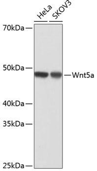 Cell Biology Antibodies 17 Anti-Wnt5a Antibody CAB19133