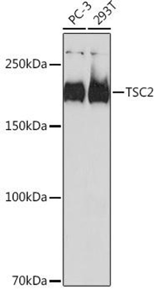 Immunology Antibodies 3 Anti-TSC2 Antibody CAB19540