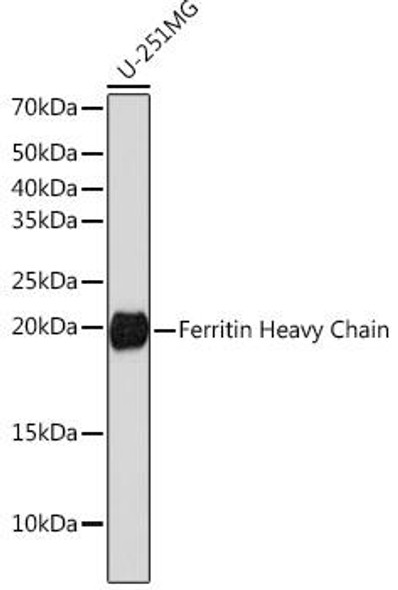 Cell Biology Antibodies 17 Anti-Ferritin Heavy Chain Antibody CAB19544