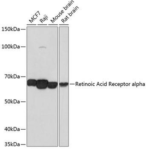 Epigenetics and Nuclear Signaling Antibodies 5 Anti-Retinoic Acid Receptor alpha Antibody CAB19551