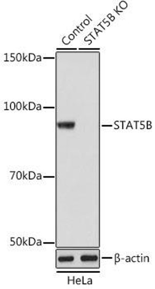 KO Validated Antibodies 2 Anti-STAT5B Antibody KO Validated CAB19567