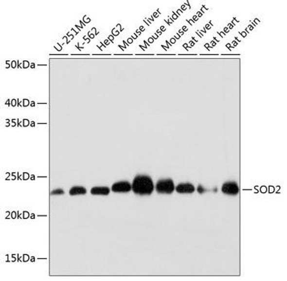 Cell Biology Antibodies 17 Anti-SOD2 Antibody CAB19576